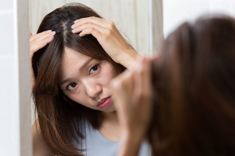 つむじ割れが治らない女性の改善方法｜横や後頭部にある分け目も対策可能 iqumore ／ イクモア：女性の薄毛や抜け毛対策。いつまでもきれいな髪を